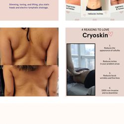 Body by Sisily - CryoSkin 4.0