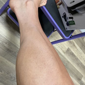 Mist Fine Airbrush Tanning - Streaks and forgot to spray the bottom of my leg. - Spray Tanning Near Me - Lafayette, California Mist Fine Airbrush Tanning - Streaks and forgot to spray the bottom of my leg. - Spray Tanning Near Me - Lafayette, California