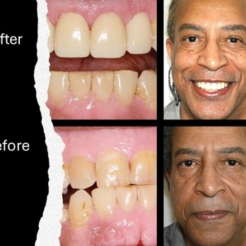 Advanced Care Dentistry - The Smile you Deserve! - Cosmetic Dentists Near Me - Scottsdale, Arizona Advanced Care Dentistry - The Smile you Deserve! - Cosmetic Dentists Near Me - Scottsdale, Arizona