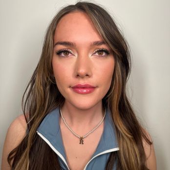 Refreshed M.D. - Today after two mini lip fillers (total of 3.5 months) - Medical Spas Near Me - Portland, Oregon