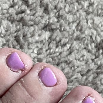 The Nail Lounge and Day Spa - Crusty looking toes part 2 - Hair Salons Near Me - Pooler, Georgia The Nail Lounge and Day Spa - Crusty looking toes part 2 - Hair Salons Near Me - Pooler, Georgia