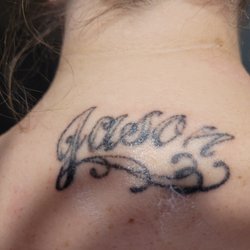 Arizona Tattoo Removal - This was after 5 lazer sessions