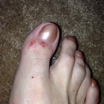 Designer Nails - Someone got a little wild with the snippers. OUCH! NOT what a pedicure should look like, people. - Nail Salons Near Me - Keizer, Oregon