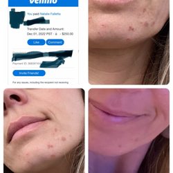 Natalie Falletta Skin Care - Payment for service verification and actual results.