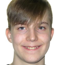 Garn & Mason Orthodontics - His canines were very high up and the bite wasn't straight