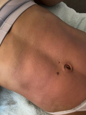 Lipo Lounge Jax by null