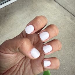 Cuts on fingers