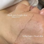 SKIN CARE BY AQ - Updated February 2025 - 36 Photos & 19 Reviews ...