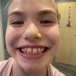 DiMarzio Orthodontics - First day getting braces.