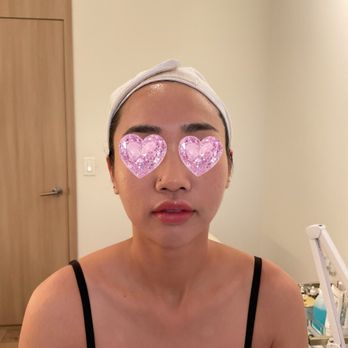 Genesys Laser Clinic - Second time Shurink - Laser Hair Removal Near Me - New York, New York Genesys Laser Clinic - Second time Shurink - Laser Hair Removal Near Me - New York, New York