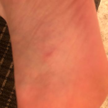 Palace Nails & Spa - Scrapped and swollen feet - Nail Salons Near Me - Atascadero, California