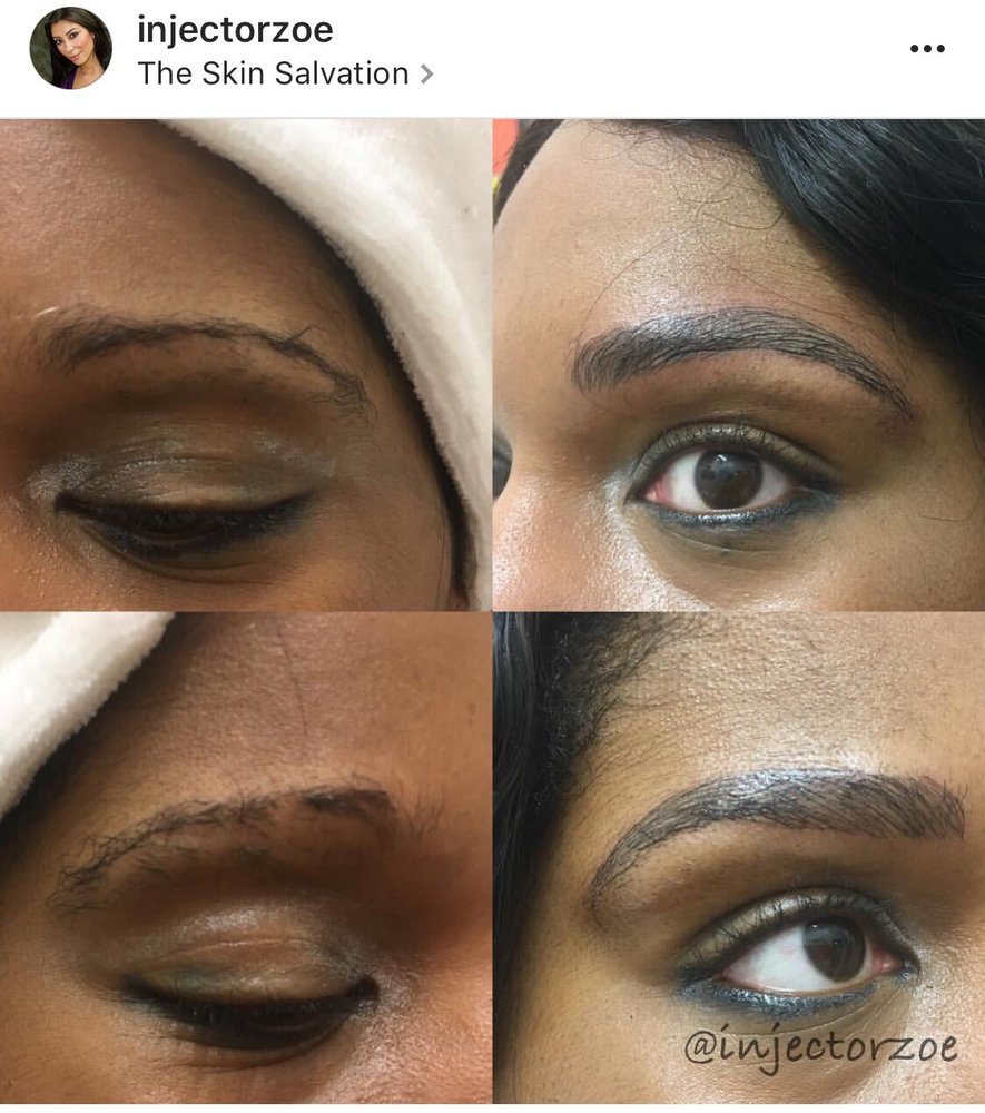The Skin Salvation Logo