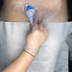 Bare by Tal - A Vajacial treatment, which includes a cleanse, mild enzyme exfoliant, extractions of ingrown hairs, followed by a custom mask.