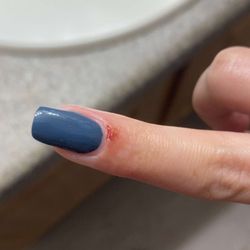 Blu Star Nails And Spa - Cut after service and after I cleaned it a couple times.