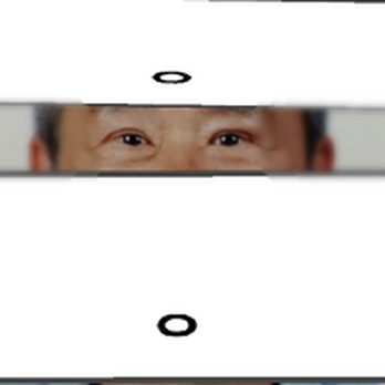 Victor Liu, MD - All 3 blepharoplasty performed by Dr. Liu came out uneven. Message me your email and I will respond with a higher definition photo. - Cosmetic Surgeons Near Me - San Francisco, California Victor Liu, MD - All 3 blepharoplasty performed by Dr. Liu came out uneven. Message me your email and I will respond with a higher definition photo. - Cosmetic Surgeons Near Me - San Francisco, California