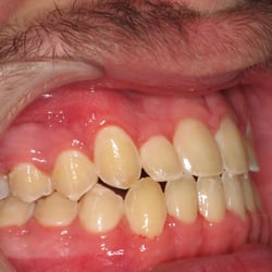 Kubicki Donald J, DDS - Non extraction No surgery