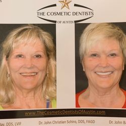 The Cosmetic Dentists of Austin