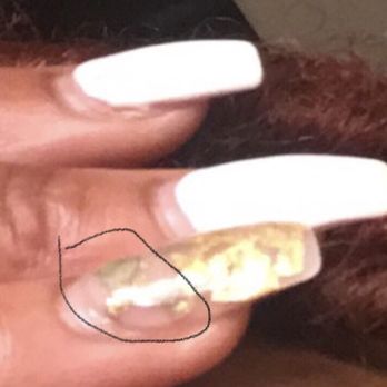 Rico Nail - You can clearly see the discoloration of the nail here - Nail Salons Near Me - Smyrna, Georgia Rico Nail - You can clearly see the discoloration of the nail here - Nail Salons Near Me - Smyrna, Georgia