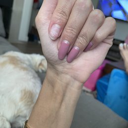 Literally one week later and both these fingers on each hand came off already and it already looks so grown out =\ Literally one week later and both these fingers on each hand came off already and it already looks so grown out =\