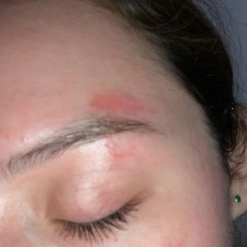 Blink Browz Art - Guy threaded on top of botched wax he caused - Threading Services Near Me - Denton, Texas Blink Browz Art - Guy threaded on top of botched wax he caused - Threading Services Near Me - Denton, Texas
