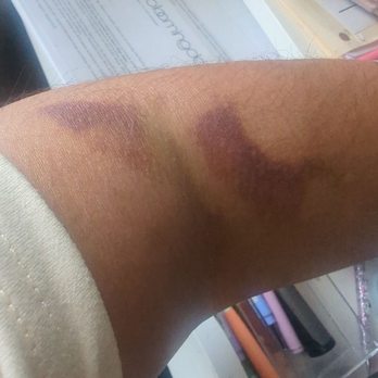 BioLife Plasma Services - This was Thursday of this past week - Blood & Plasma Donation Centers Near Me - San Bernardino, California