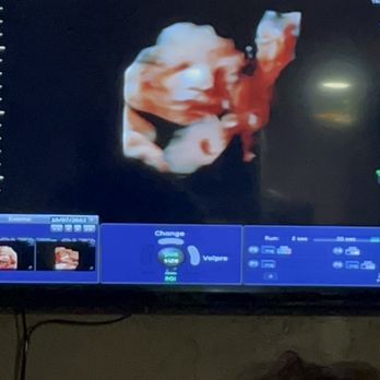 Miracle View 3D/4D Ultrasound - Obstetricians & Gynecologists Near Me - Phoenix, Arizona