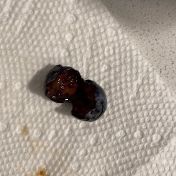H Mart - Cambridge - Rotten blueberries sold in H mart - Grocery Near Me - Cambridge, Massachusetts H Mart - Cambridge - Rotten blueberries sold in H mart - Grocery Near Me - Cambridge, Massachusetts