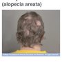 Photo of Leticia Isabel Hair Replacement