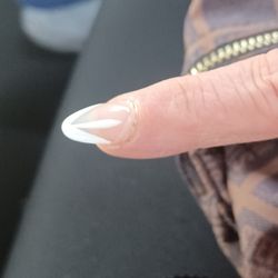 Near the cuticle of my mom's nails look bubbled like there's something underneath or they're lifting or something