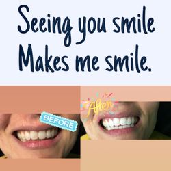 Blown Away Spray Tanning - Making Roanoke brighter one smile at a time.