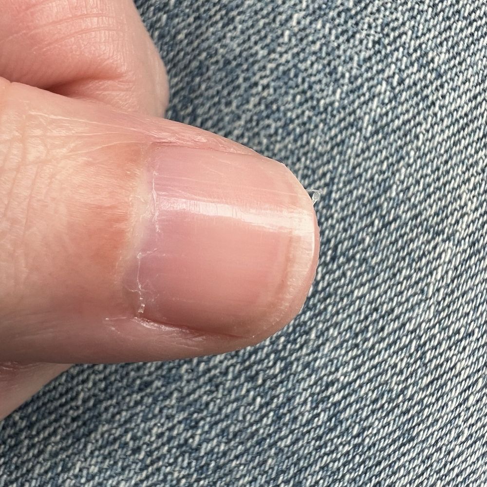 Nails Creations & Day Spa - Jagged nail, cuticles ripped up and not removed - Nail Salons Near Me - Buford, Georgia Nails Creations & Day Spa - Jagged nail, cuticles ripped up and not removed - Nail Salons Near Me - Buford, Georgia