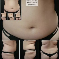 Beauty Sculpt Just For You