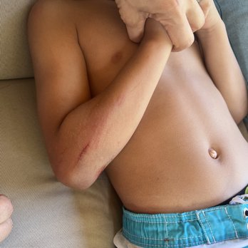 Bay Area Jump - Injury from the slide completely toppling over!! - Party Supplies Near Me