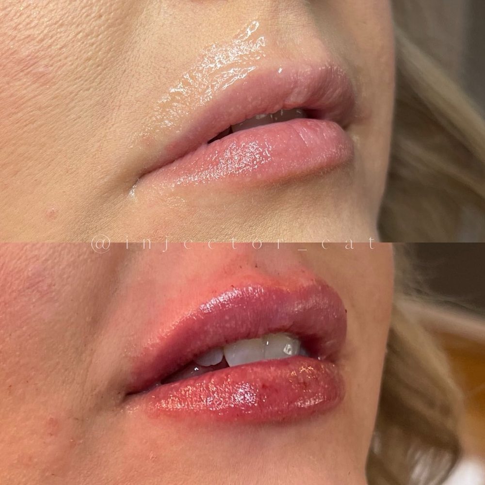 SMILEY AESTHETICS NASHVILLE Updated October 2024 7058 Charlotte