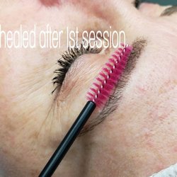Strokes of Beauty By Tia - 1st session healed results. 2 sessions required