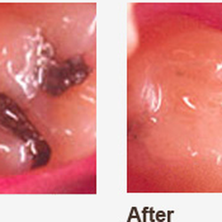 Advanced Dental Group