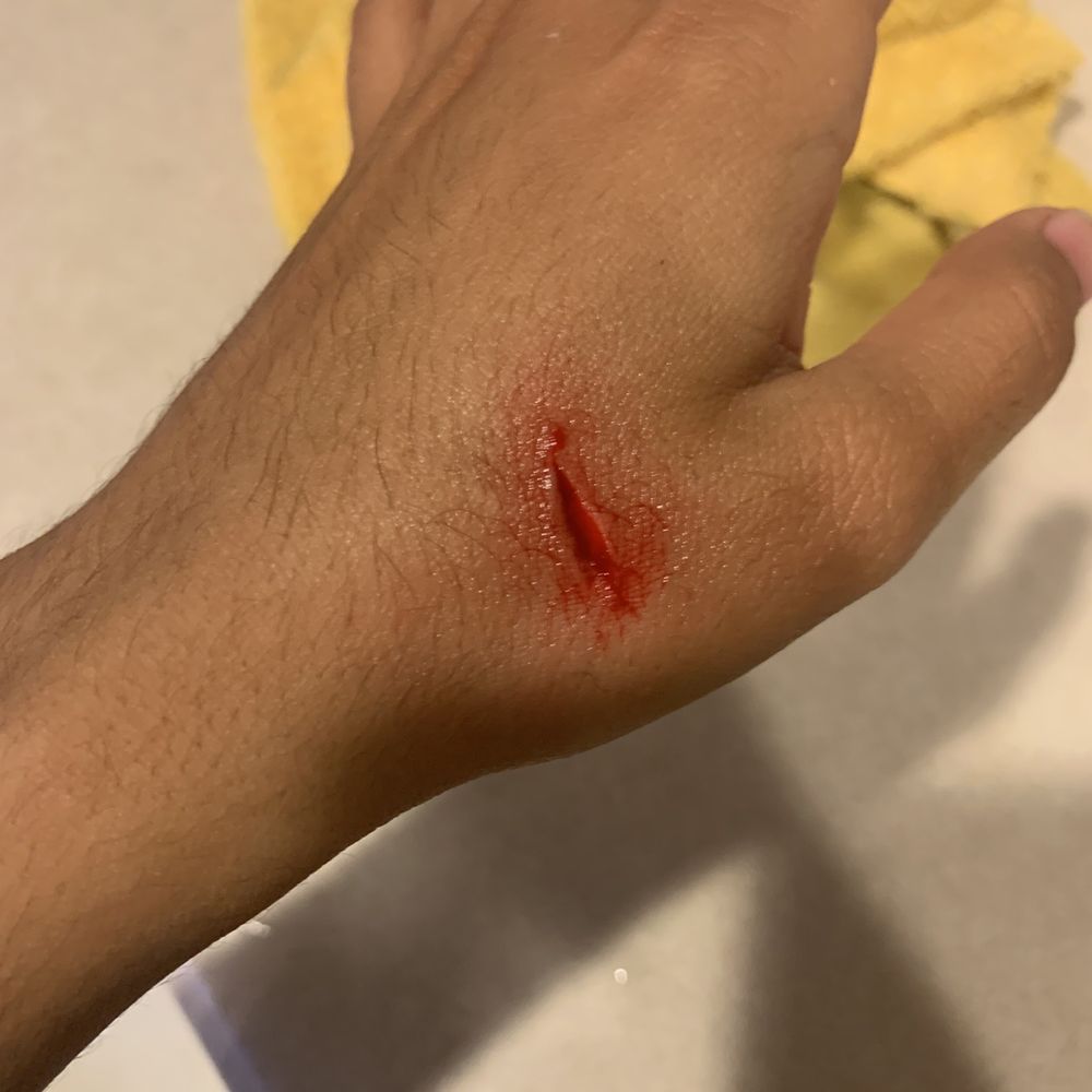 When I cut myself, instead of the fruit When I cut myself, instead of the fruit