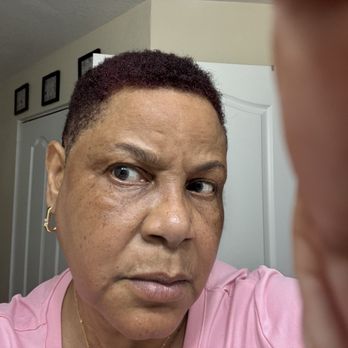 Dedicated Senior Medical Center - Parasite embedded in my face & Nasolacrimal ducts . Parasite embedded imprint right forehead - Acupuncture Near Me - Winter Park, Florida Dedicated Senior Medical Center - Parasite embedded in my face & Nasolacrimal ducts . Parasite embedded imprint right forehead - Acupuncture Near Me - Winter Park, Florida