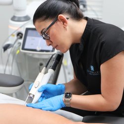 Skintellect Laser & Aesthetics - Laser vein removal treatment targeting visible spider veins with precision for clearer, more even-looking skin.