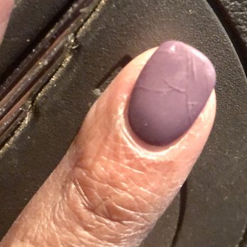 LUNA Nails & Spa - Messed up powder dip job only a few days old - Nail Salons Near Me - Washington, DC, District of Columbia
