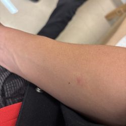Concentra Urgent Care - Rohnert Park - Maybe a doctor stuck in traffic can check my shi