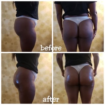 Embodee'd - Milan Beauty Bar - Body Contouring Near Me - Flower Mound, Texas