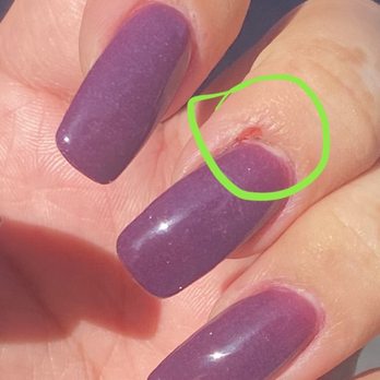 Glossi Nail Bar - Day after manicure - do you see how deep this cut is? Horrible. - Nail Salons Near Me - Colma, California Glossi Nail Bar - Day after manicure - do you see how deep this cut is? Horrible. - Nail Salons Near Me - Colma, California