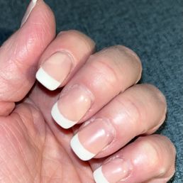 They're lifted toward the cuticle nearly 50% on two fingers. They're lifted toward the cuticle nearly 50% on two fingers.