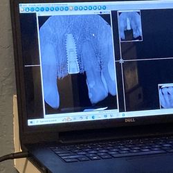 Flagstaff Laser Dentistry
