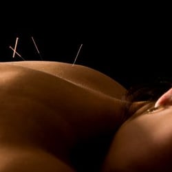 Emerge Acupuncture
