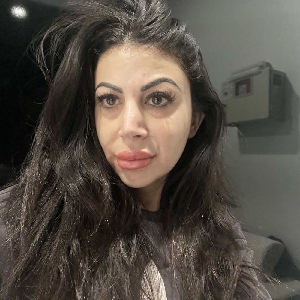 This was taken right after the procedure