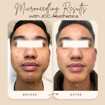 JCC Aesthetics - IV Hydration Near Me - Orange, California JCC Aesthetics - IV Hydration Near Me - Orange, California