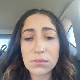 my very irritated eye from having a makeup "professional" wipe my eye with a bleach cleaning wipe.