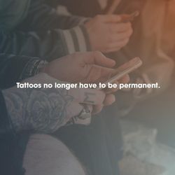 Removery Tattoo Removal & Fading